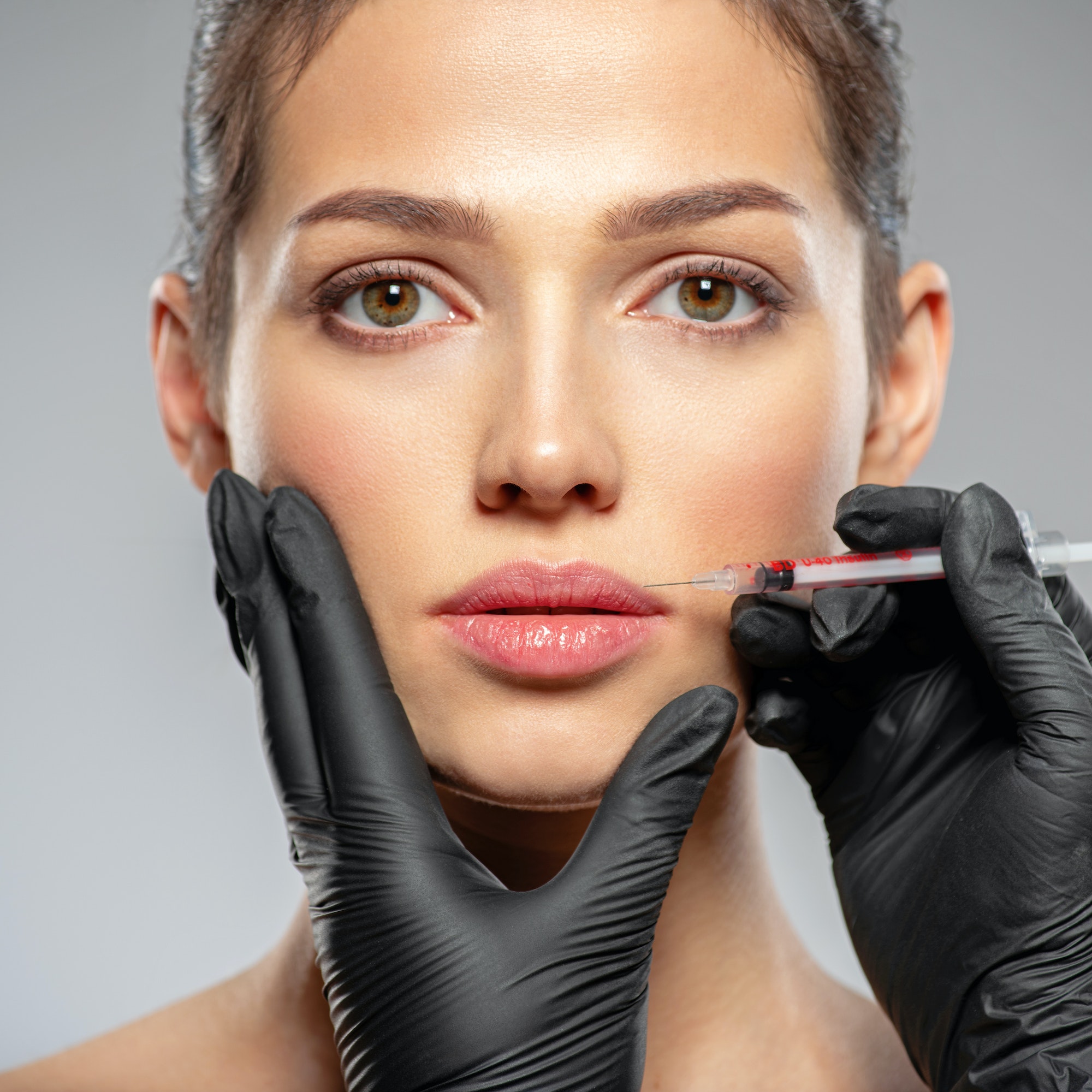 Caucasian woman getting botox cosmetic injection in the lips. Woman gets botox injection in her face